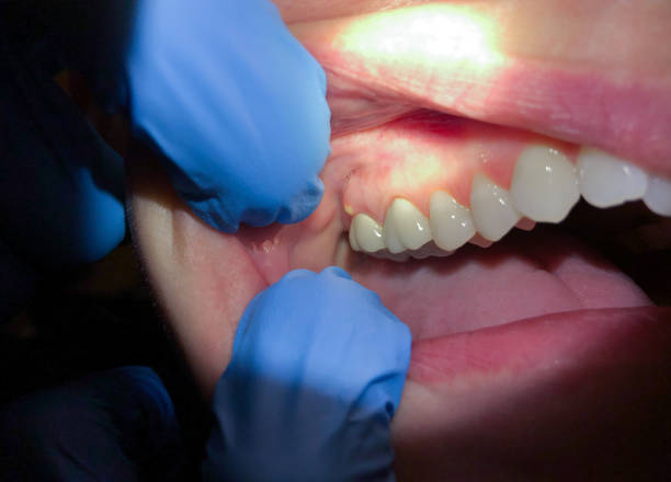 Best Emergency Tooth Extraction  in Coopersville, MI