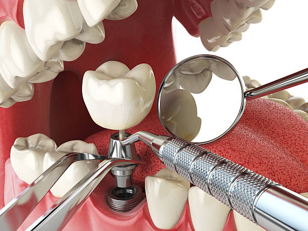 Best Tooth Pain Emergency Relief  in Coopersville, MI