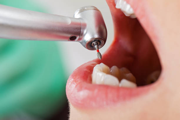 Best Emergency Dental Filling Replacement  in Coopersville, MI